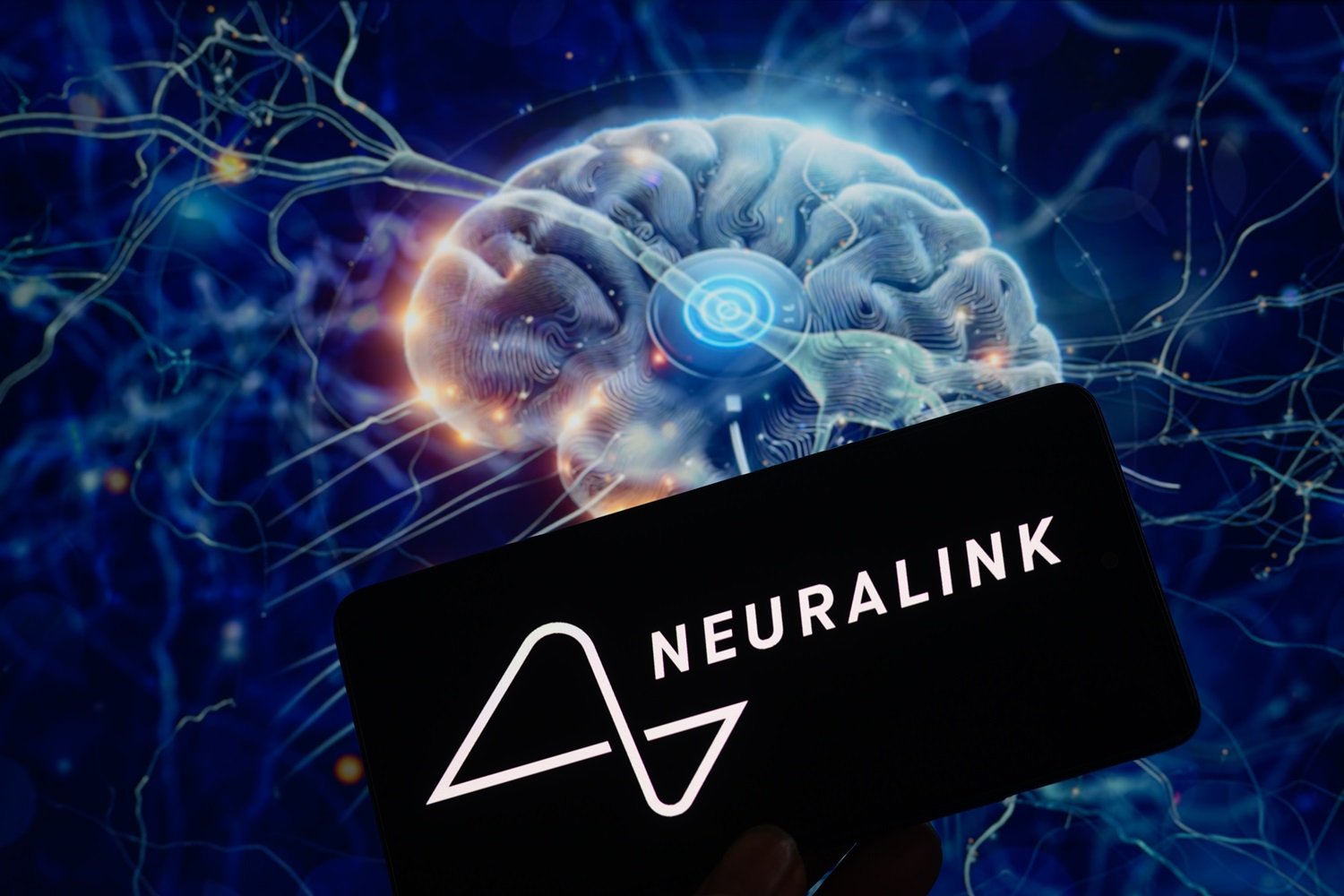The brain startup suffers a minor setback.