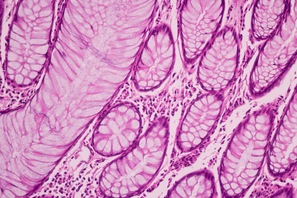 A new study from Yale researchers shows how artificial intelligence can bring different kinds of data together, giving scientists and doctors a clearer picture of what is happening inside the body and how diseases&nbsp;develop.