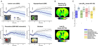 Magnetic resonance imaging (MRI) of glucose metabolism shows significant potential for identifying disease biomarkers and monitoring therapeutic responses in neurological conditions. Here, we present a protocol utilizing chemical exchange-sensitive spin-lock …